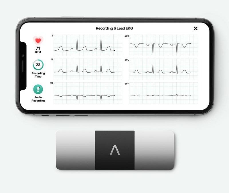 Palpitations Monitor